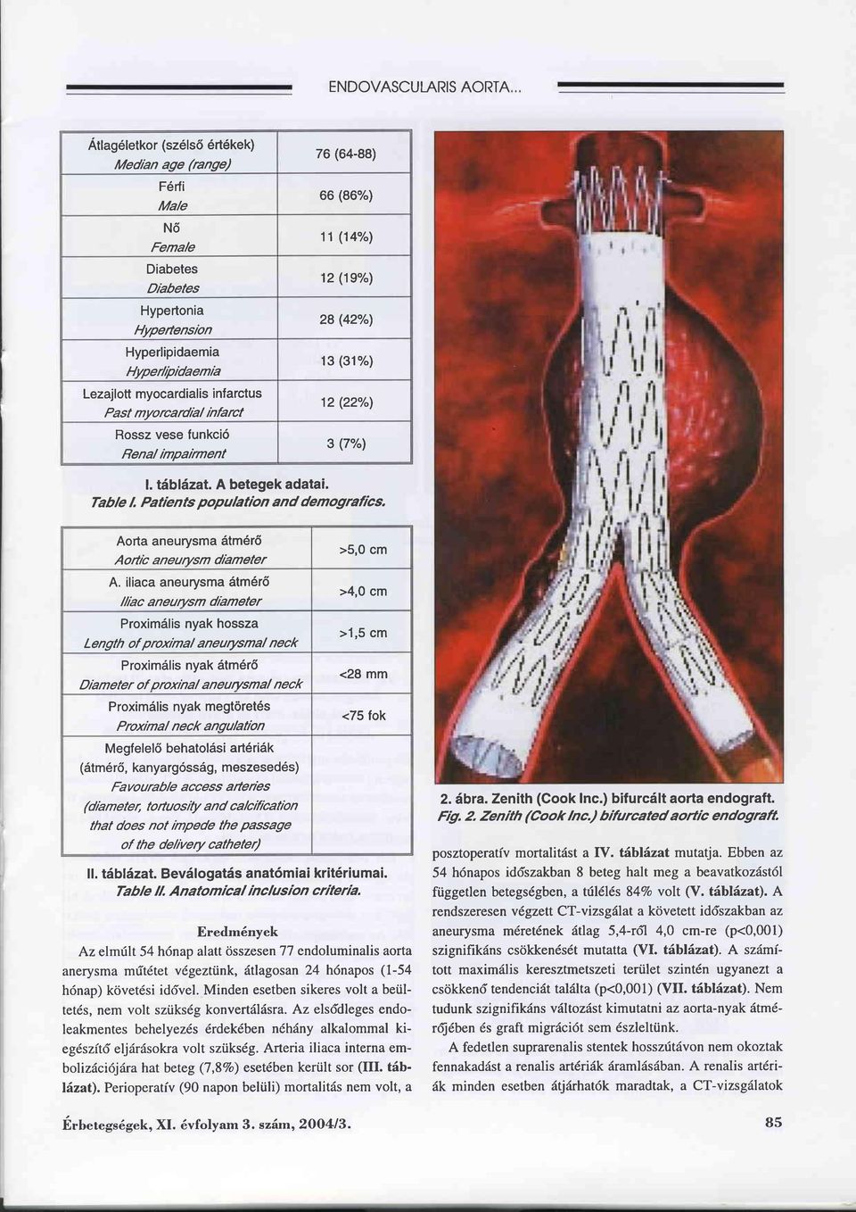Table L Patients populatrbn and demografics. Aorta aneurysma ätm6rö A o ftrb a ne u rysm dra m eter A.