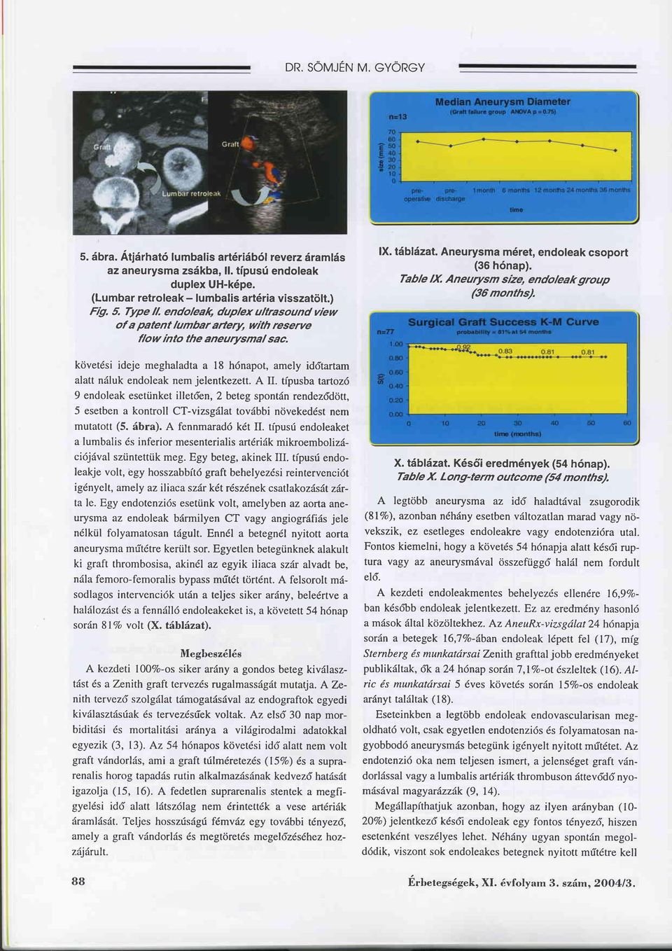 követdsi ideje meghaladta a l8 h6napot, amely iddtartam alatt näluk endoleak nem jelentkezett.