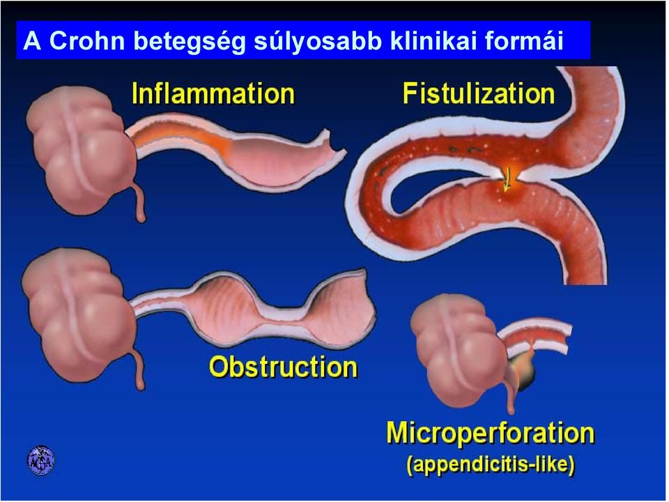 súlyosabb