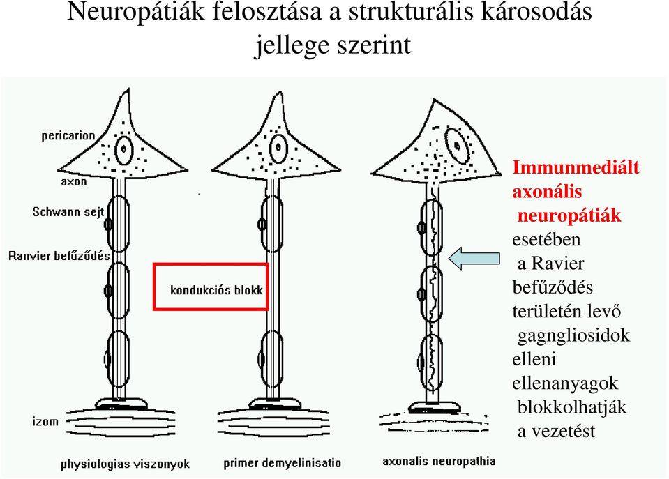 esetében a Ravier befűződés területén levő