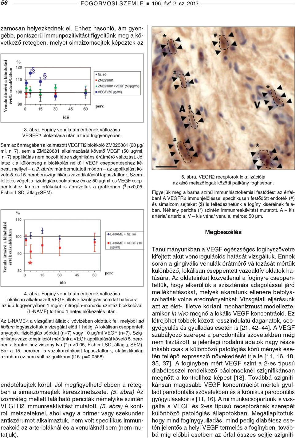 Sem az önmagában alkalmazott VEGFR2 blokkoló ZM323881 (20 µg/ ml, n=7), sem a ZM323881 alkalmazását követő VEGF (50 µg/ml, n=7) applikálás nem hozott létre szignifikáns érátmérő változást.