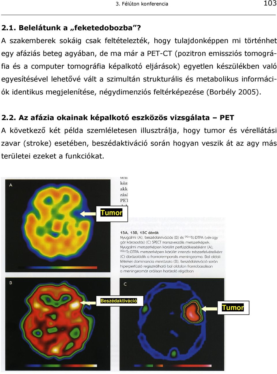 tomográfia képalkotó eljárások) egyetlen készülékben való egyesítésével lehetővé vált a szimultán strukturális és metabolikus információk identikus megjelenítése,