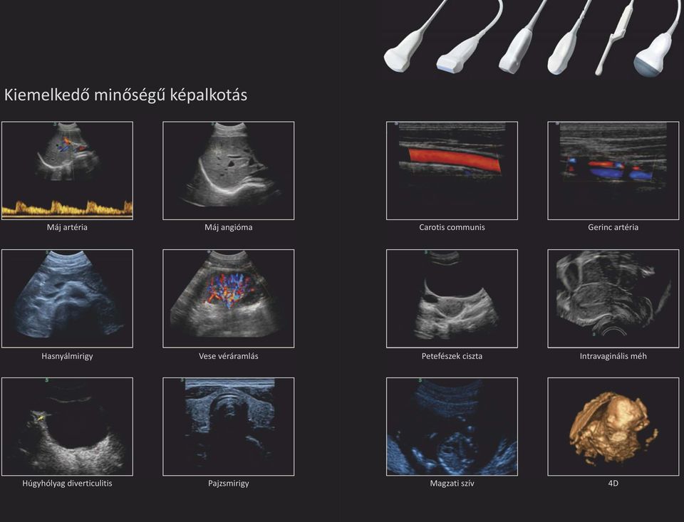 Hasnyálmirigy Vese véráramlás Petefészek ciszta