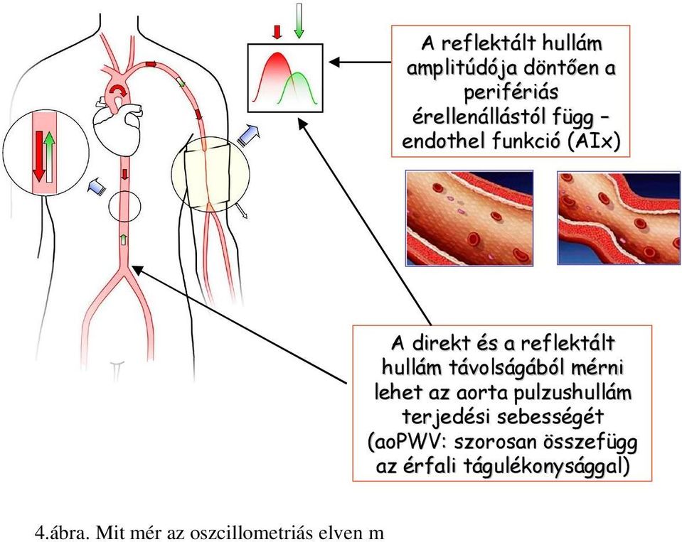 A Pécsi Egyetem Szívgyógyászati Klinikáján elvégzett invazív validációk egyértelműen igazolták, hogy az arteriográf által regisztrált non-invazív nyomásgörbe tökéletesen identikus az invazív úton,