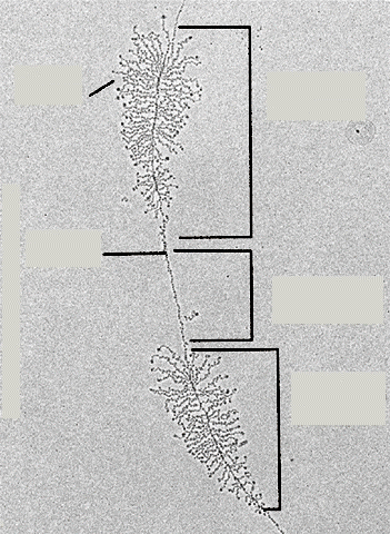 Az alábbi elektronmikroszkópos felvételen a pre-rrns transzkripciós egységek két tandem kópiája látható.