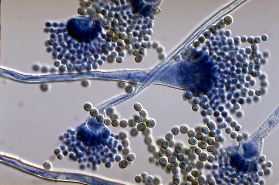 Fungi are usually pathogenic Only a few microscopic (unicellular) yeasts are present in the normal flora Dimorf