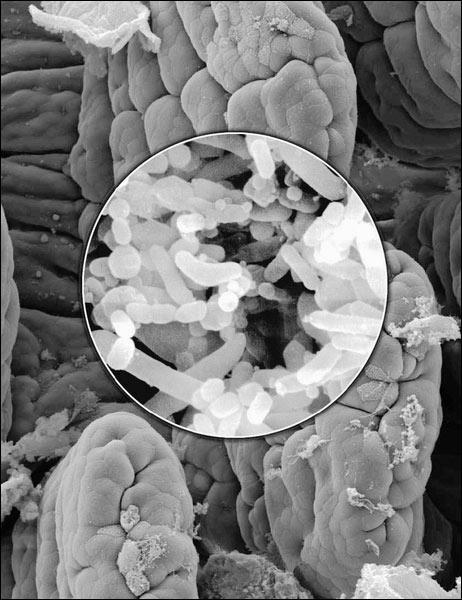 Competition for nutrients The colon is very rich in nutrients, has a constant temperature, low