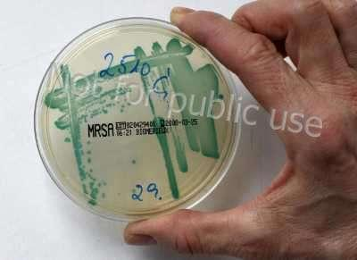 Bacterial species Previously only those bacteria were studied which grew in culture More than 90 % of bacteria can not be cultured in vitro The sensitivity of PCR-coupled sequencing allows us to