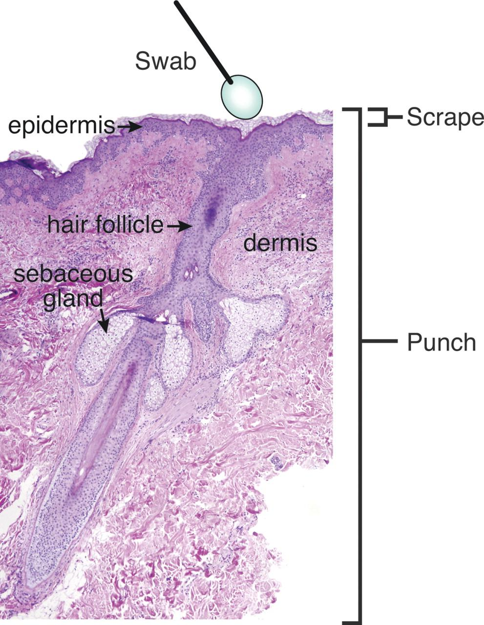 Who is living with us? Skin flora: how to tell?