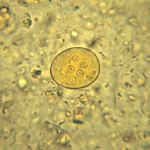 Entamoeba coli A cysta kerek vagy kissé ovális, 10-35 µm átmérőjű, a magok száma rendszerint nyolc. E. coli az egyetlen Entamoeba faj melynek több mint 4 magja van a cysta formában (http://www.dpd.