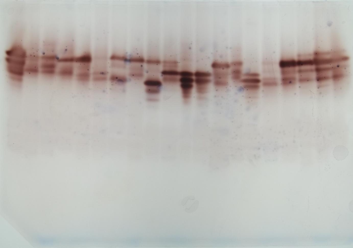 12. ábra: A vizsgált fajták cathecol-oxidáz