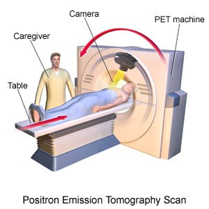 10 Orvosi alkalmazás pozitron-emissziós tomográf (PET) Rövid