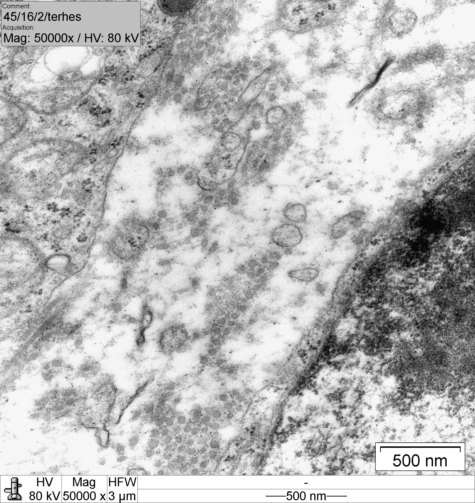 EXTRACELLULAR VESICLES AT