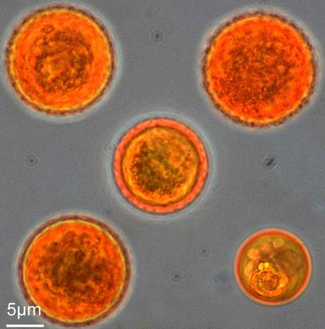 Dunaliella salina Chlorophyta, Volvocales Telített, 32% sóoldatban