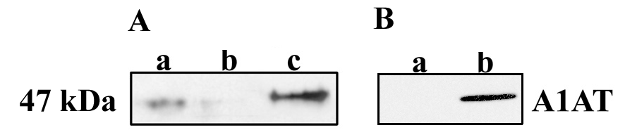 14. ábra. Bakteriálisan expresszált preprohepcidin. A preprohepcidint a pgex4t-1 expressziós vektorba klónoztuk, majd BL21 baktériumtörzsbe transzformáltuk.