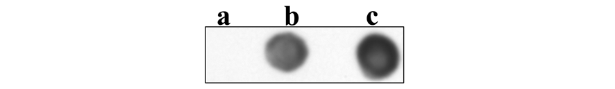 az A1AT és a prohepcidin in vivo interakcióját a szérumban. A kísérletben a szabad (nem kötött) prohepcidint tartalmazó szérum ultrafiltrátum szolgált negatív kontrollként (19. ábra)