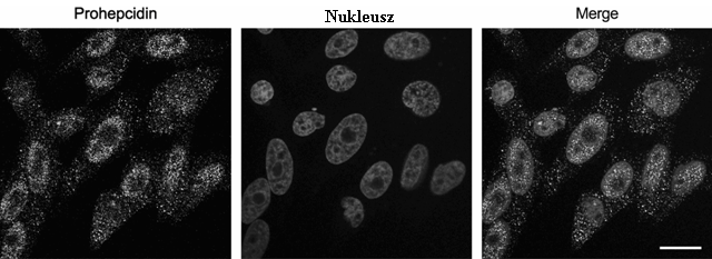 21. ábra. A prohepcidin a WRL68 májsejtek citoplazmájában és a sejtmagjában lokalizálódik. A WRL68 sejteket prohepcidin/ptriex3-neo plazmiddal transzfektáltuk.