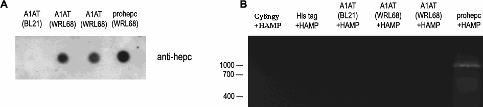 26. ábra. Az A1AT által kötött prohepcidin nem lép interakcióba a HAMP promóterrel.