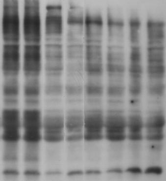 Relatív denzitás (egység) DOI:10.14753/SE.2014.1878 A karbonilált fehérjék mennyisége jelzi az oxidatív fehérjesérülések mértékét.