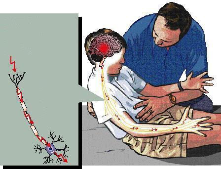 Epilepsziás roham A viselkedés