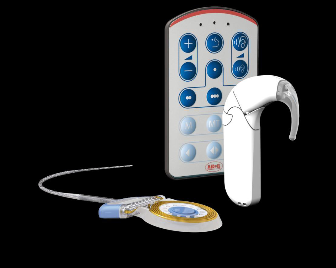 A cochlearis implantátum működése Kétoldali belsőfül eredetű nagyothallás/süketség esetén a külső