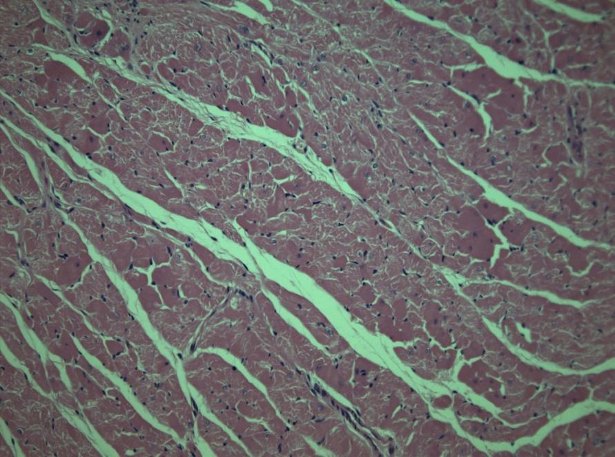 Diameters of myocyte (µm) AFRW hatása a cardiomyocita