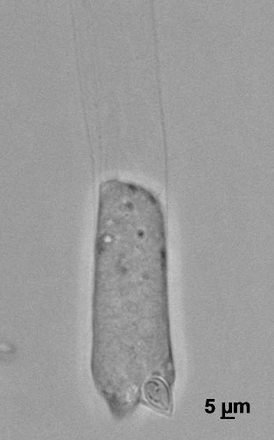 2. ábra: Myxobolus cerebralis aktinospóra poláris kapszula fénymikroszkóp alatt (1984) írta le a Myxobolus cerebralis fejlődésmenetét.