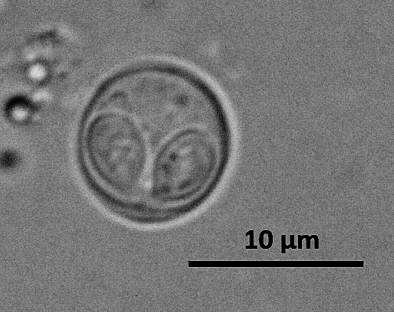 2.2 Myxobolus cerebralis (Hofer, 1903) Súlyos patogenitásának köszönhetően a legismertebb és legtöbbet tanulmányozott faj a nyálkaspórások közül (Lom and Dykova, 1992).