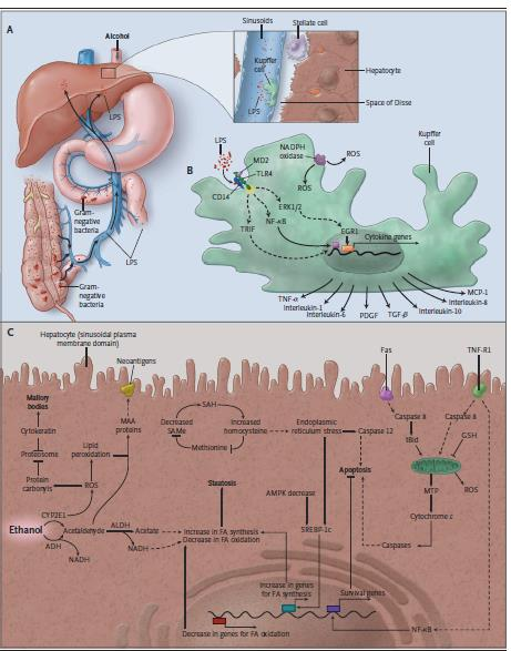 Aspects of the Pathophysiology of Alcohol-Induced Liver Injury Ethanol promotes the translocation of