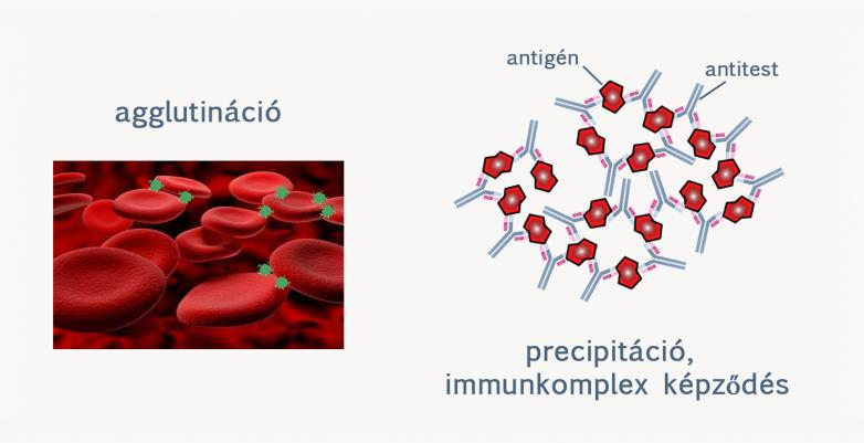 A szérumbetegség emberben Schick és Pirquet eredeti megfigyelései szerint többnyire lázzal, lymphadenopathiával, polyarthritissel, proteinuriával és utrcicariával jár.