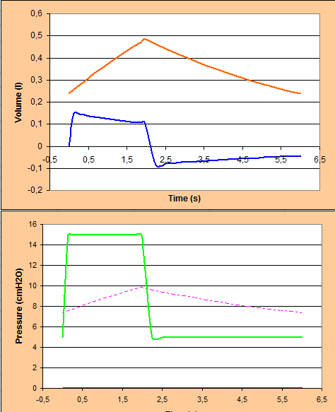 V T = flow x T i = P/R x T i V T = 10H 2 Ocm / 5H 2