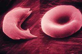 sejtkortex A sejt alakját meghatározza a citoplazma mutáció ES HS megváltozott morfológia Defects that interrupt the vertical spectrin interactions are the