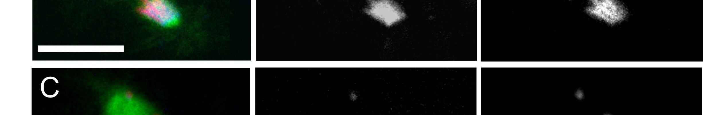 festett imp-α2 D14 /imp-β KetRE34 és imp-α2 D14 /imp-β Ketc02473 ; nos-gal4-nlsb