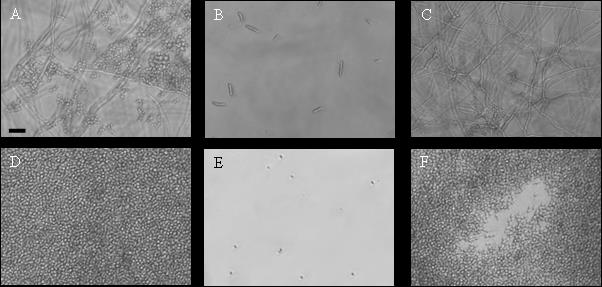Eredmények 9. ábra: Különböző NCR peptid kezelések in vitro hatása fonalas és élesztőszerűen növő gombákra. A-C: Tr. mentagrophytes; D-F: C. albicans.