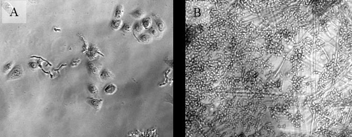 Eredmények 21. ábra: NCR peptidek hatása PK E6/E7 vaginális epitélsejtek és C. albicans kevert kultúrájára. A 20.