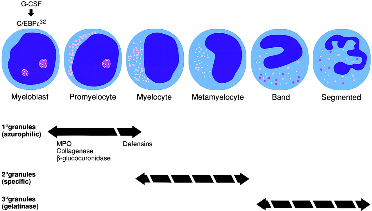 Granulum-defektusok Primer granulum a termékei átfedők, egyes faktorok (MPO) hiánya nem fokozza az érzékenységet fertőzésekkel szemben ELA-2 (neutrophil elastase) primer granulum-defekt, ciklikus