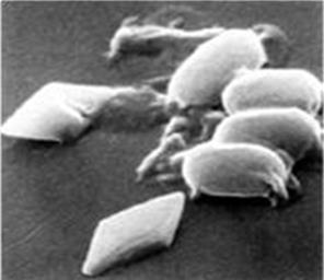 METÓDY OCHRANY RASTLÍN EKOLOGICKÉHO VINOHRADNÍCTVA László Gyula Mikrobiologická ochrana rastlín proti obaľovačom Bacillus thuringiensis kurstaki (BTK) je taký kmeň baktérie, ktorý produkuje toxickú