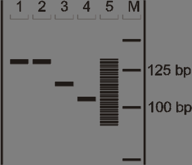 mutattak (azonos magasságban helyezkedtek el a gélben), az az IgH génátrendeződés egyezésére, az adott mintapár klonális kapcsolatára utalt (14. ábra). 14.