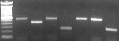 VI.2 A mintákban előforduló V H géncsaládok A minták IgV H génjeit a 6 V H géncsaládra specifikus sense és a J H -ra specifikus antisense PCR segítségével amplifikáltuk.