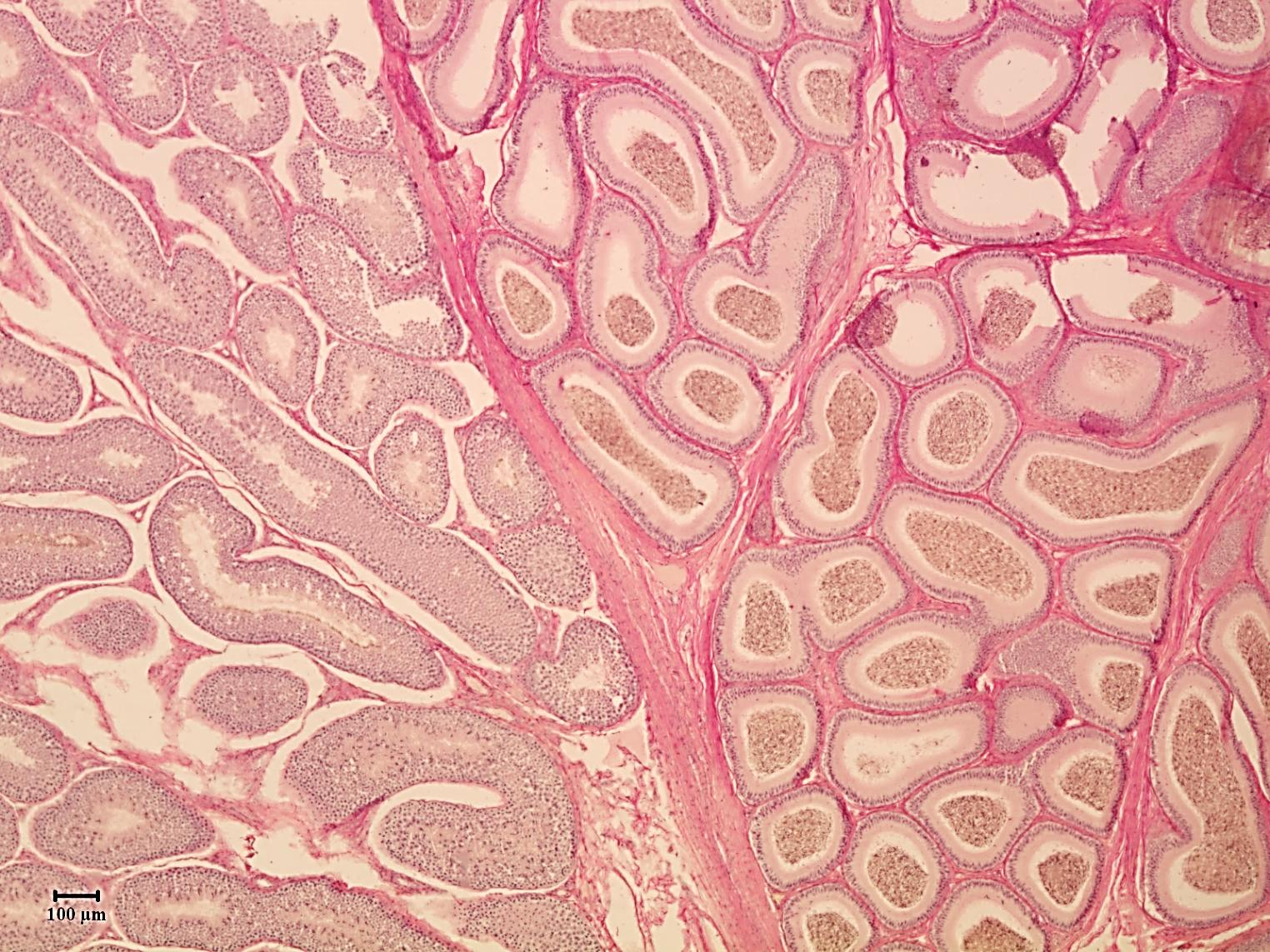 Here (testis) és mellékhere (epididymis)