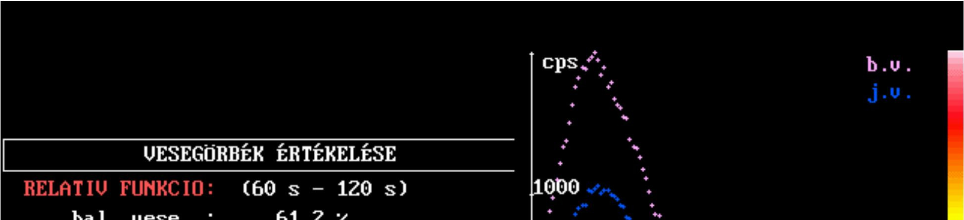 dietilén-triaminpentaecetsav merkapto-acetiltriglicin