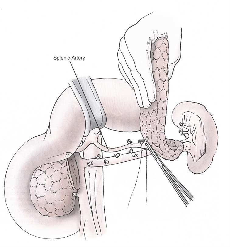 analysis of pancreatic and periampullary tumours: 1. Are there any symptoms that might indicate operability or inoperability? 2.