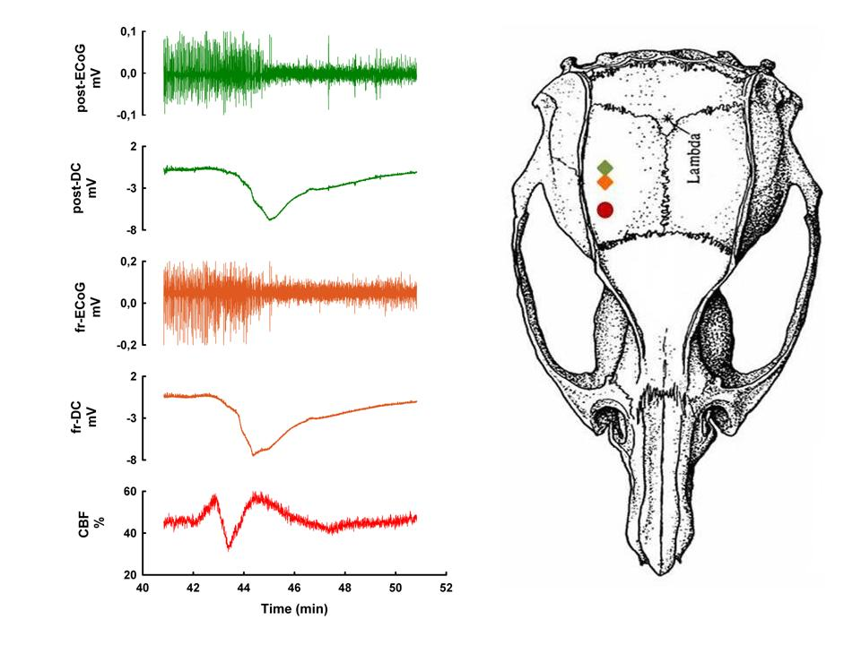 2. ábra Epidurális DC, ECoG és véráramlás (cerebral blood flow, CBF) mérés filament okklúzió során. A két ezüst-klorid elektróda (négyzettel jelölve) (frontális (fr) and posterior (occ)) 2 ill.