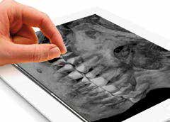 OrisWin DG Suite 3D Egyetlen szoftver, számtalan lehetőség Az OrisWin DG Suite képalkotó szoftver segítségével a fogorvos könynyedén nyilvántarthatja a páciensek adatait, összegyűjtheti a