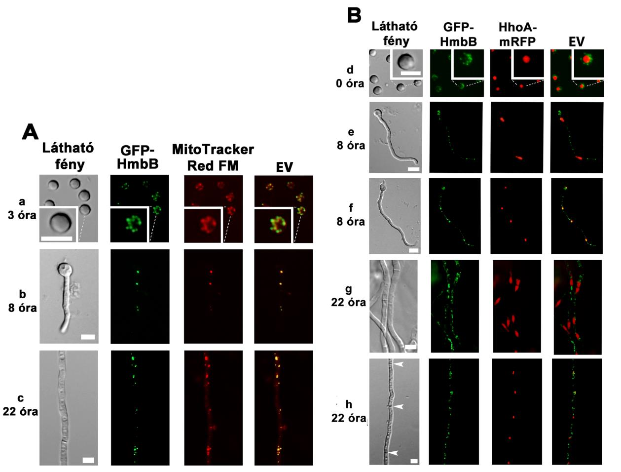 27. ábra: A GFP-HmbB fúziós fehérje sejten belüli elhelyezkedése az ivartalan ciklus különböző szakaszaiban. A: A GFP-HmbB (HZS.