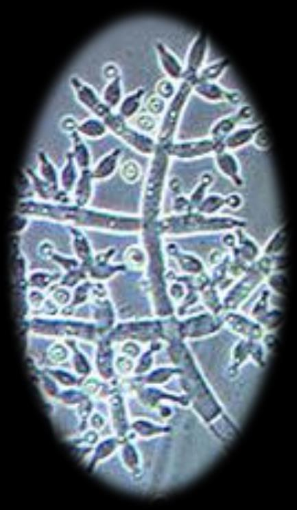 A mikrobiológiai oltóanyagok csoportosítása PGPR baktériumok Növényi növekedést serkentik (víz, tápanyag, stimulánsok biztosítása) Rhizobium baktériumok Nitrogénkötés