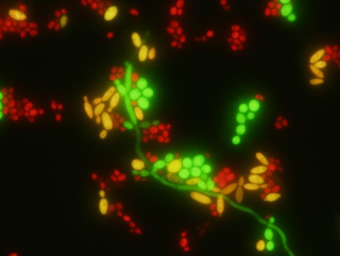 4. ábra Fluoreszcencia mikroszkópiás kép a különböző sarjadzógombák kimutatásakor különböző színű (hullámhosszon emittáló) fluoreszcens-csoportokkal jelölt PNS szálak alkalmazásával.