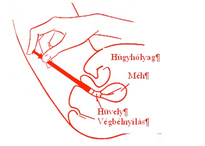 A hüvelytablettát tartalmazó applikátort vezessük óvatosan, mélyen a hüvelybe (a legoptimálisabb felhelyezést fekvő helyzetben érjük el). 3.