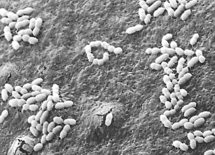 A malolaktikus fermentáció optimális Baktérium faj körülményei Oenococcus oeni Lactobacillus plantarum Technológiai fázis az alkoholos erjedéssel párhuzamosan (csak starterkultúrás