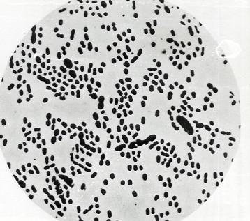 oeni fermentation cocci homolactic DL rod rod rod rod rod rod cocci (ovoid) homolactic heterolactic heterolactic